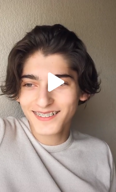Patricio Fernandez had braces