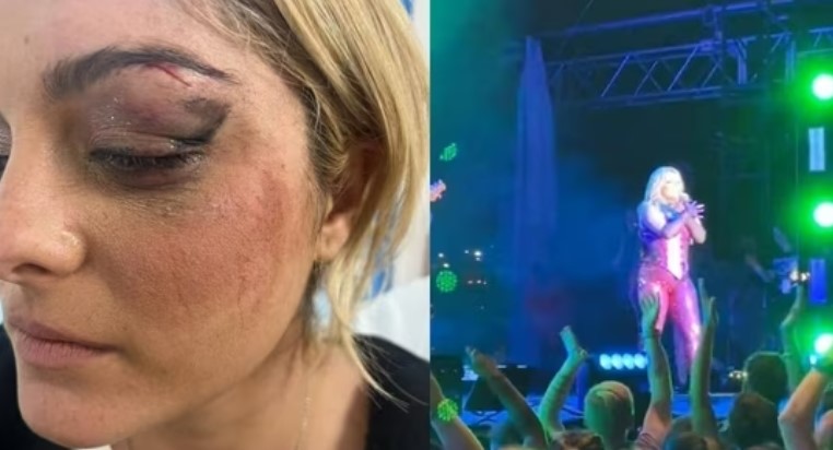 The unfortunate incident caused Bebe Rexha's concert